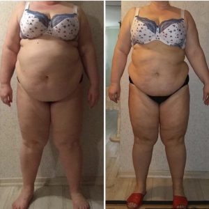 metamorfozy przed i po aplikacja miazga 00002