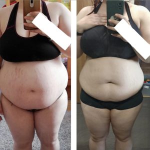 metamorfozy przed i po aplikacja miazga 00006