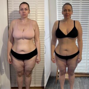 metamorfozy przed i po aplikacja miazga 00007