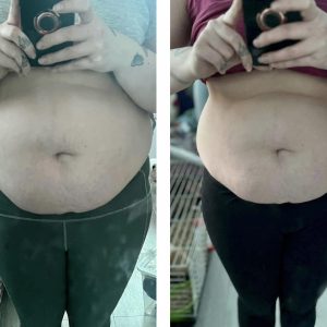 metamorfozy przed i po aplikacja miazga 00010