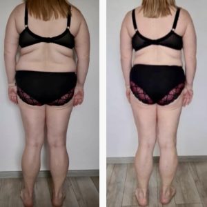 metamorfozy przed i po aplikacja miazga 00014