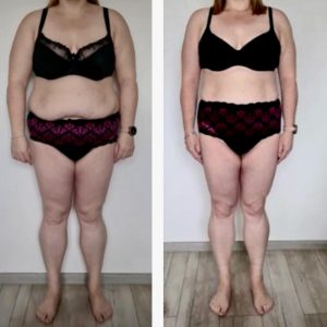 metamorfozy przed i po aplikacja miazga 00018