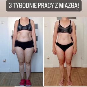 metamorfozy przed i po aplikacja miazga 00022