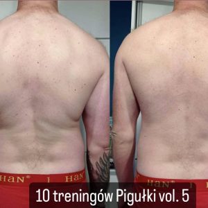 metamorfozy przed i po aplikacja miazga 00024