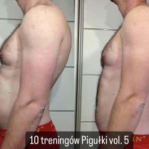 metamorfozy przed i po aplikacja miazga 00025