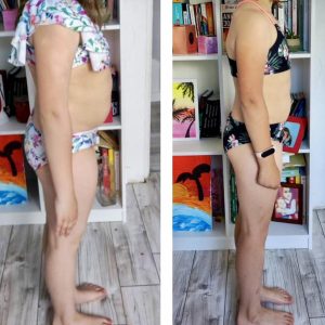 metamorfozy przed i po aplikacja miazga 00028