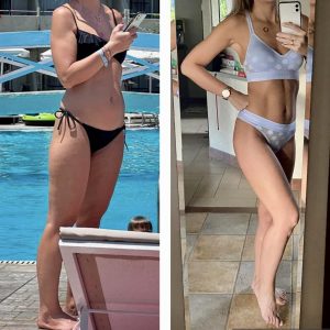 metamorfozy przed i po aplikacja miazga 00030