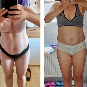 metamorfozy przed i po aplikacja miazga 00034