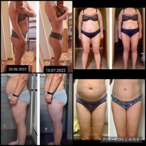 metamorfozy przed i po aplikacja miazga 00036