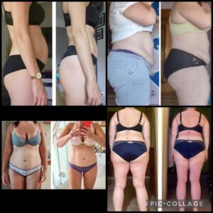 metamorfozy przed i po aplikacja miazga 00038