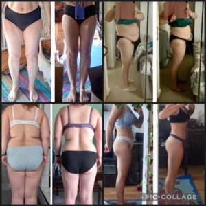 metamorfozy przed i po aplikacja miazga 00039