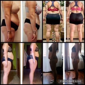 metamorfozy przed i po aplikacja miazga 00040