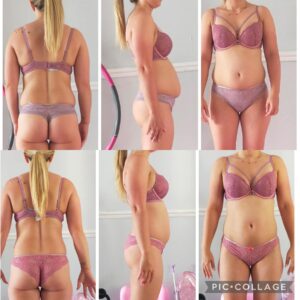 metamorfozy przed i po aplikacja miazga 00041