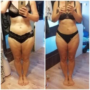 metamorfozy przed i po aplikacja miazga 00042