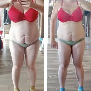 metamorfozy przed i po aplikacja miazga 00043