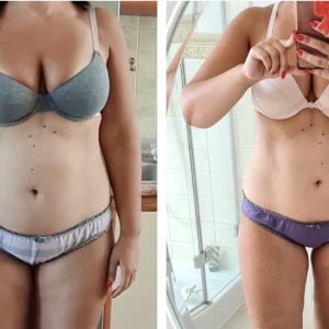 metamorfozy przed i po aplikacja miazga 00044