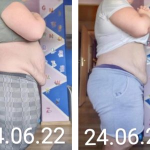 metamorfozy przed i po aplikacja miazga 00046