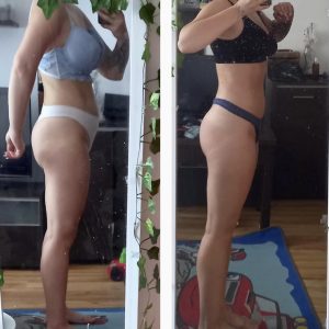 metamorfozy przed i po aplikacja miazga 00049