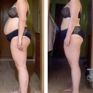 metamorfozy przed i po aplikacja miazga 00051