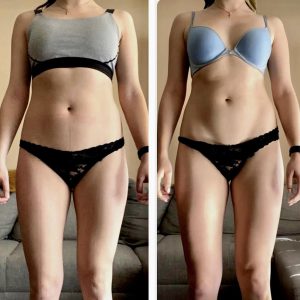 metamorfozy przed i po aplikacja miazga 00052