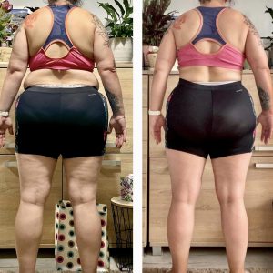 metamorfozy przed i po aplikacja miazga 00053