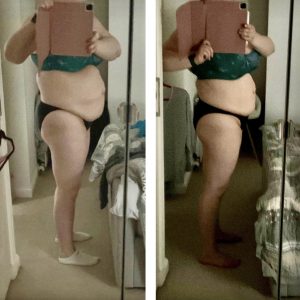 metamorfozy przed i po aplikacja miazga 00056