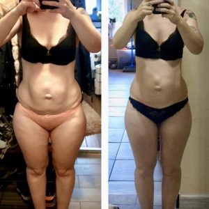 metamorfozy przed i po aplikacja miazga 00059