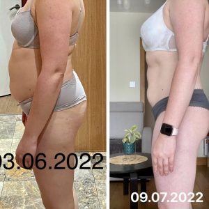 metamorfozy przed i po aplikacja miazga 00060