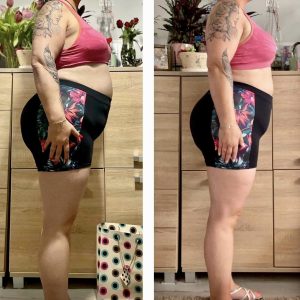 metamorfozy przed i po aplikacja miazga 00063