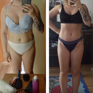 metamorfozy przed i po aplikacja miazga 00064