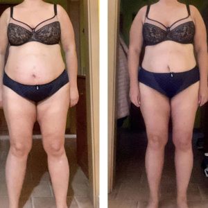 metamorfozy przed i po aplikacja miazga 00066