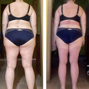 metamorfozy przed i po aplikacja miazga 00069