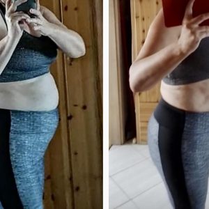 metamorfozy przed i po aplikacja miazga 00071