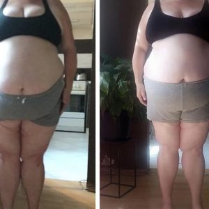 metamorfozy przed i po aplikacja miazga 00074