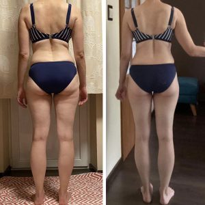 metamorfozy przed i po aplikacja miazga 00075