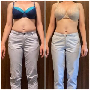 metamorfozy przed i po aplikacja miazga 00076