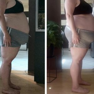 metamorfozy przed i po aplikacja miazga 00077