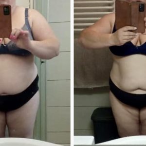 metamorfozy przed i po aplikacja miazga 00078