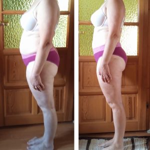 metamorfozy przed i po aplikacja miazga 00080