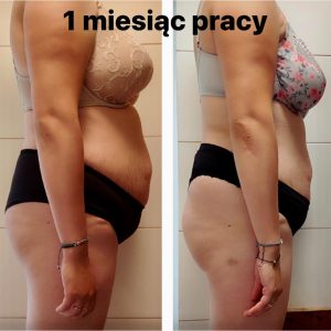 metamorfozy przed i po aplikacja miazga 00081