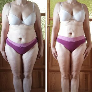 metamorfozy przed i po aplikacja miazga 00082