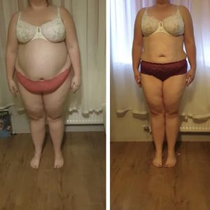 metamorfozy przed i po aplikacja miazga 00083