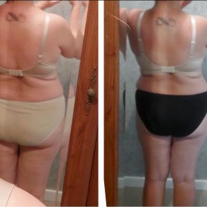 metamorfozy przed i po aplikacja miazga 00084