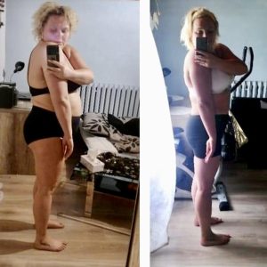 metamorfozy przed i po aplikacja miazga 00087