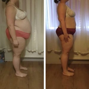 metamorfozy przed i po aplikacja miazga 00089