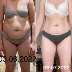 metamorfozy przed i po aplikacja miazga 00090