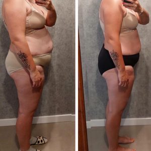 metamorfozy przed i po aplikacja miazga 00091