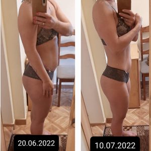 metamorfozy przed i po aplikacja miazga 00094