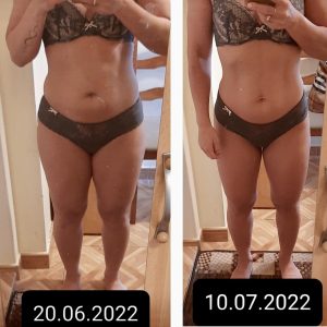 metamorfozy przed i po aplikacja miazga 00096