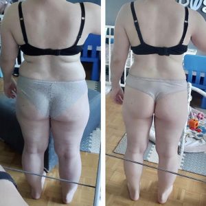 metamorfozy przed i po aplikacja miazga 00097